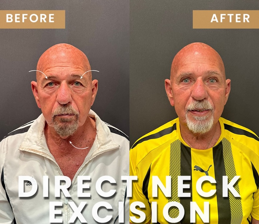 Facial Plastic Surgery and How It Benefits You